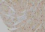 MT2A Antibody in Immunohistochemistry (Paraffin) (IHC (P))