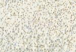 MT2A Antibody in Immunohistochemistry (Paraffin) (IHC (P))