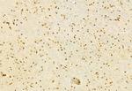 MT2A Antibody in Immunohistochemistry (Paraffin) (IHC (P))