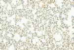 MT2A Antibody in Immunohistochemistry (Paraffin) (IHC (P))