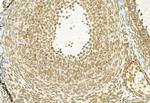 MT2A Antibody in Immunohistochemistry (Paraffin) (IHC (P))