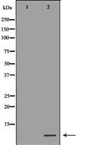 MT2A Antibody in Western Blot (WB)