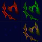 Tryptase Antibody in Immunocytochemistry (ICC/IF)