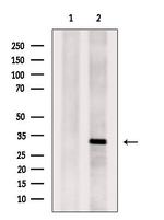 Tryptase Antibody in Western Blot (WB)