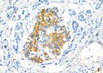 Tryptase Antibody in Immunohistochemistry (Paraffin) (IHC (P))