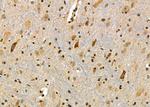 Ubiquitin Antibody in Immunohistochemistry (Paraffin) (IHC (P))