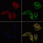 CD94 Antibody in Immunocytochemistry (ICC/IF)