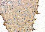 EPHX1 Antibody in Immunohistochemistry (Paraffin) (IHC (P))