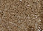 PKC epsilon Antibody in Immunohistochemistry (Paraffin) (IHC (P))