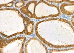 Sorbitol Dehydrogenase Antibody in Immunohistochemistry (Paraffin) (IHC (P))