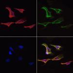 Sorbitol Dehydrogenase Antibody in Immunocytochemistry (ICC/IF)