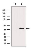 Sorbitol Dehydrogenase Antibody in Western Blot (WB)