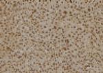 SCCPDH Antibody in Immunohistochemistry (Paraffin) (IHC (P))