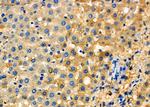 SCCPDH Antibody in Immunohistochemistry (Paraffin) (IHC (P))