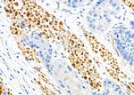 PMS1 Antibody in Immunohistochemistry (Paraffin) (IHC (P))