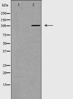 PMS1 Antibody in Western Blot (WB)