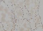 PP1 alpha Antibody in Immunohistochemistry (Paraffin) (IHC (P))