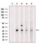 PSMA6 Antibody in Western Blot (WB)