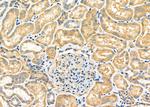 MRP4 Antibody in Immunohistochemistry (Paraffin) (IHC (P))