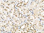 MDA5 Antibody in Immunohistochemistry (Paraffin) (IHC (P))