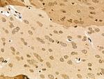 MDA5 Antibody in Immunohistochemistry (Paraffin) (IHC (P))