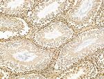 H4K20me1 Antibody in Immunohistochemistry (Paraffin) (IHC (P))