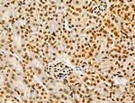 H4K20me1 Antibody in Immunohistochemistry (Paraffin) (IHC (P))