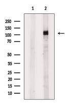 TNK2 Antibody in Western Blot (WB)