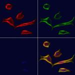 PCBP2 Antibody in Immunocytochemistry (ICC/IF)