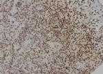 PCBP2 Antibody in Immunohistochemistry (Paraffin) (IHC (P))