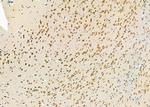 PCBP2 Antibody in Immunohistochemistry (Paraffin) (IHC (P))