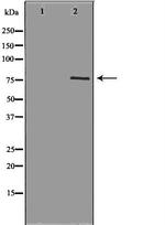 cGKI Antibody in Western Blot (WB)