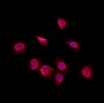 SKP1 Antibody in Immunocytochemistry (ICC/IF)