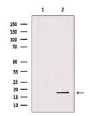 SKP1 Antibody in Western Blot (WB)