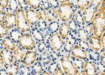 ALDH4A1 Antibody in Immunohistochemistry (Paraffin) (IHC (P))