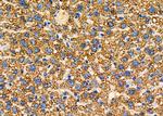 ALDH4A1 Antibody in Immunohistochemistry (Paraffin) (IHC (P))