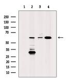 ALDH4A1 Antibody in Western Blot (WB)