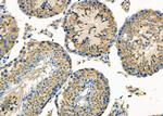 TRAP1 Antibody in Immunohistochemistry (Paraffin) (IHC (P))