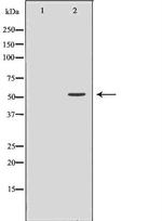 VMAT2 Antibody in Western Blot (WB)