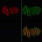 GLRA1 Antibody in Immunocytochemistry (ICC/IF)