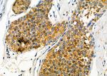 GLRA1 Antibody in Immunohistochemistry (Paraffin) (IHC (P))