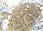 GLRA1 Antibody in Immunohistochemistry (Paraffin) (IHC (P))