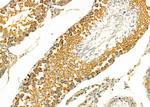 Kallikrein 2 Antibody in Immunohistochemistry (Paraffin) (IHC (P))