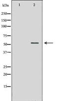 KV1.1 (KCNA1) Antibody in Western Blot (WB)