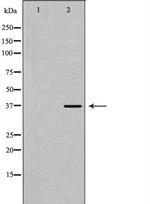 MC5R Antibody in Western Blot (WB)