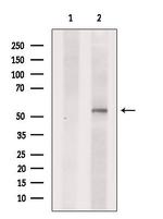 SLC16A4 Antibody in Western Blot (WB)