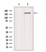 MRP5 Antibody in Western Blot (WB)