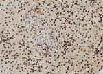 PIWIL2 Antibody in Immunohistochemistry (Paraffin) (IHC (P))