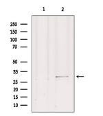 Gemin 2 Antibody in Western Blot (WB)