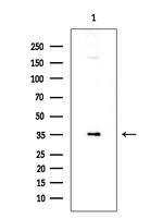 PP2A beta Antibody in Western Blot (WB)